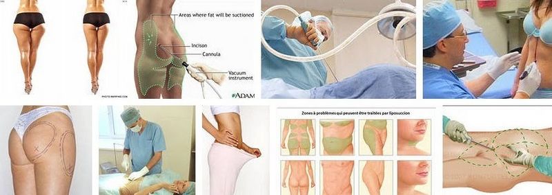 Как похудеть за неделю без диет